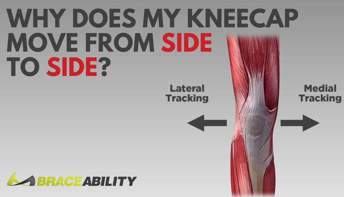 how to tell if your kneecap is broken