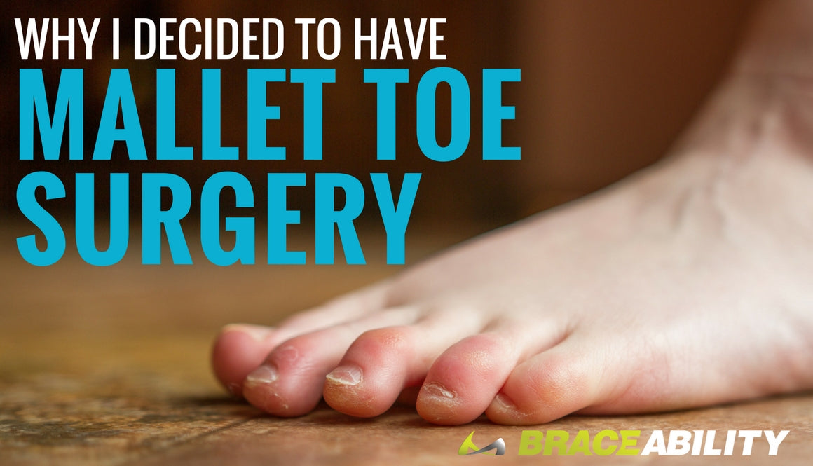 Mallet Toe Surgery Exercises for Curled Toes & PostOp Recovery