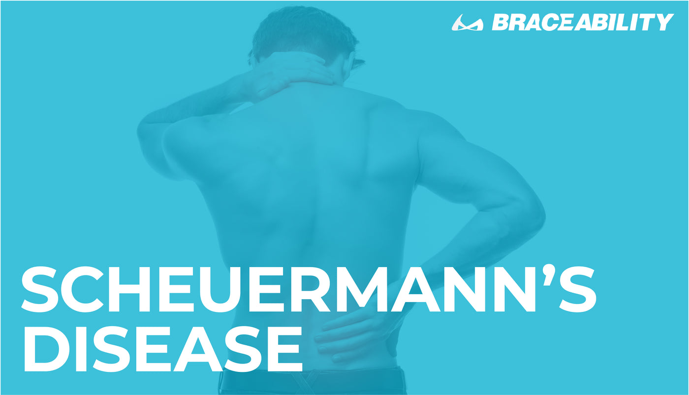 Scheuermann S Disease The Truth About Your Child S Hunched Back
