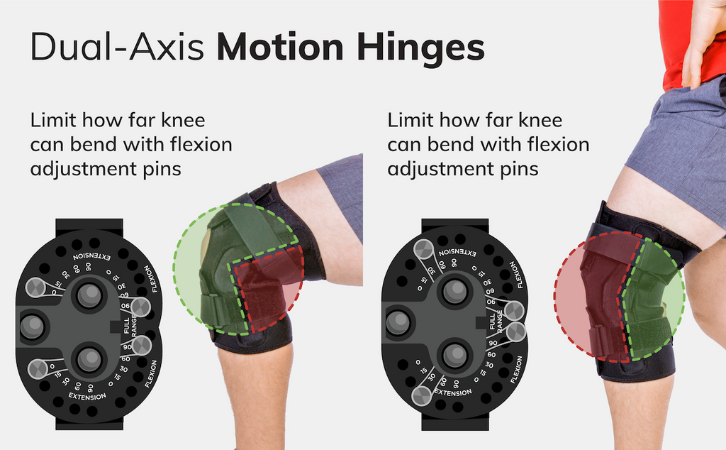 dual-axis motion hinges in the rom knee brace limit range of motion after a knee injury