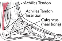 learn about achilles tendon foot anatomy and causes of achilles tendonitis