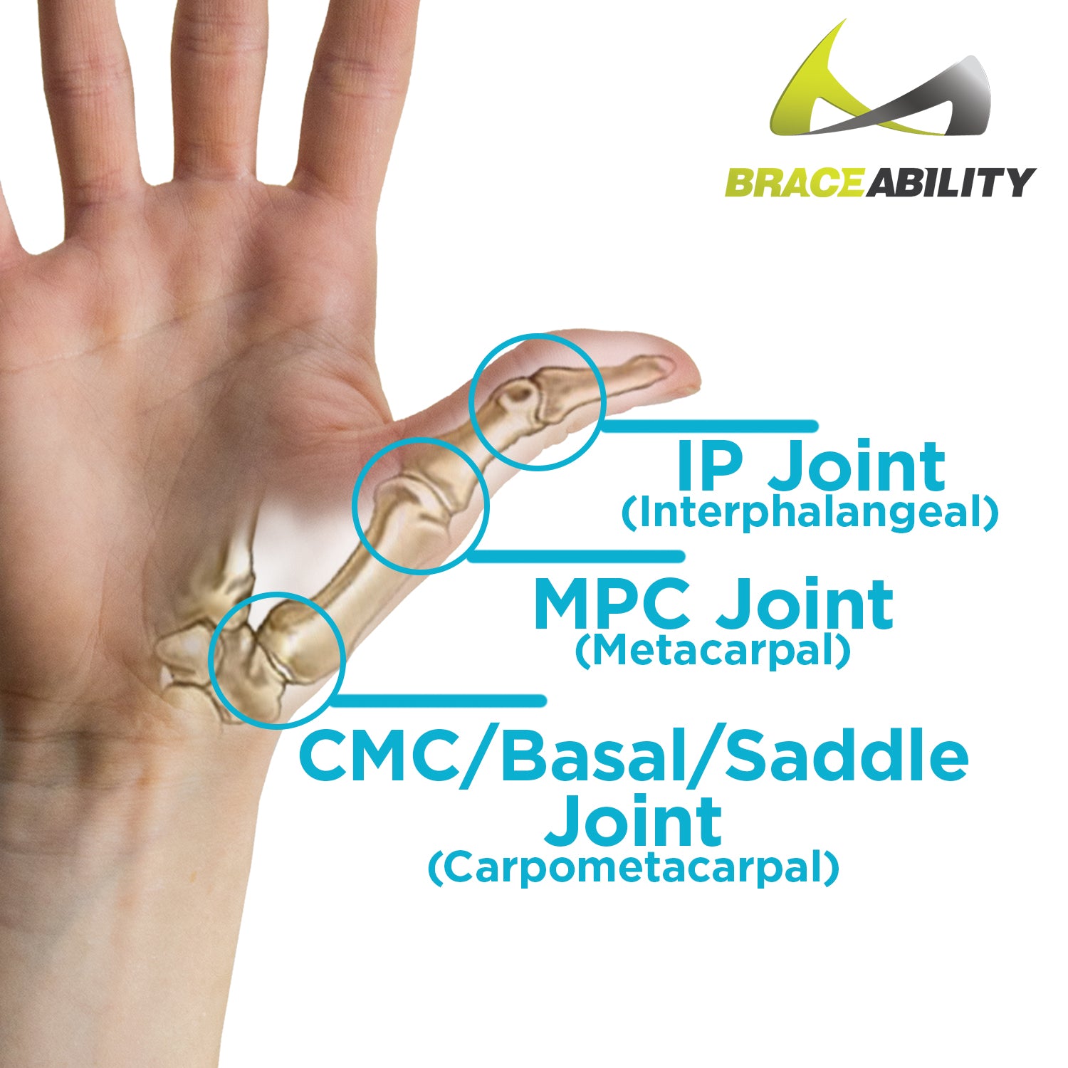 labeled thumb joint anatomy affected in thumb pain