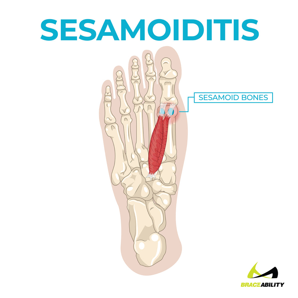 tendonitis bottom of foot