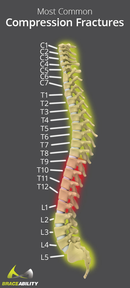 common location of compression fractures in the spine