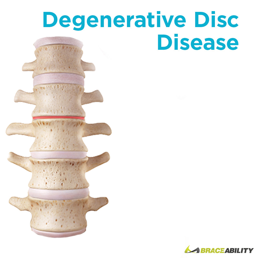 anatomy of degenerative disc disease in your spine