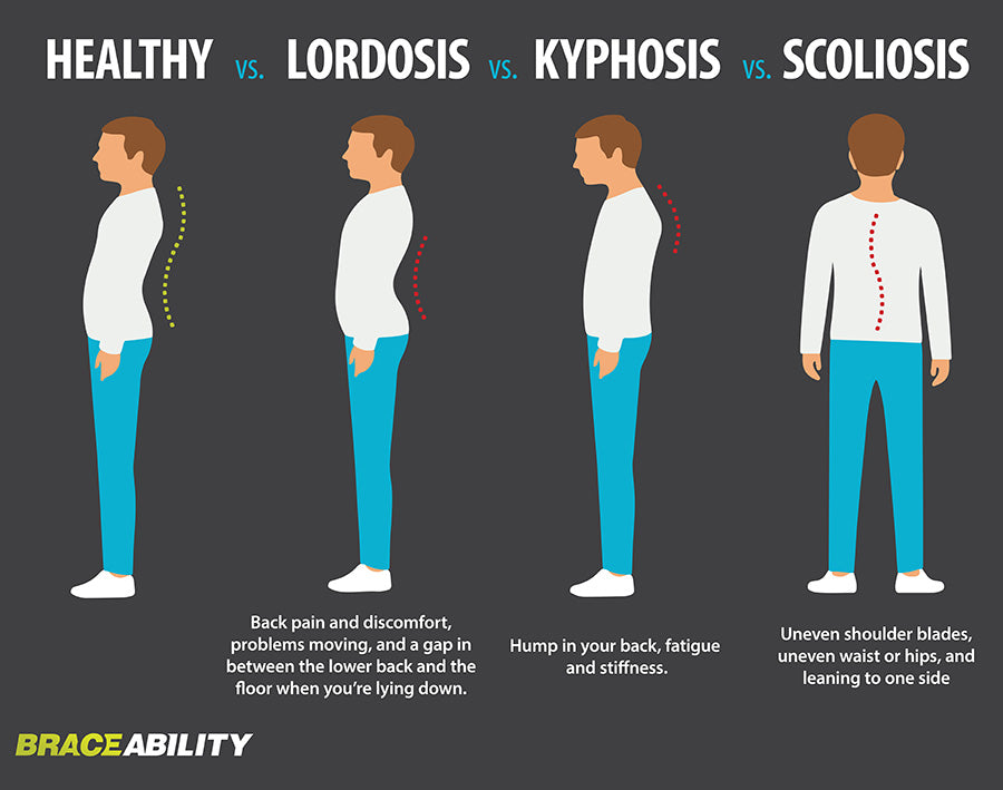 Difference between lordosis, kyphosis and scoliosis in spinal curve