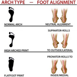 foot arch types affect foot alignment and can cause foot pain and injury