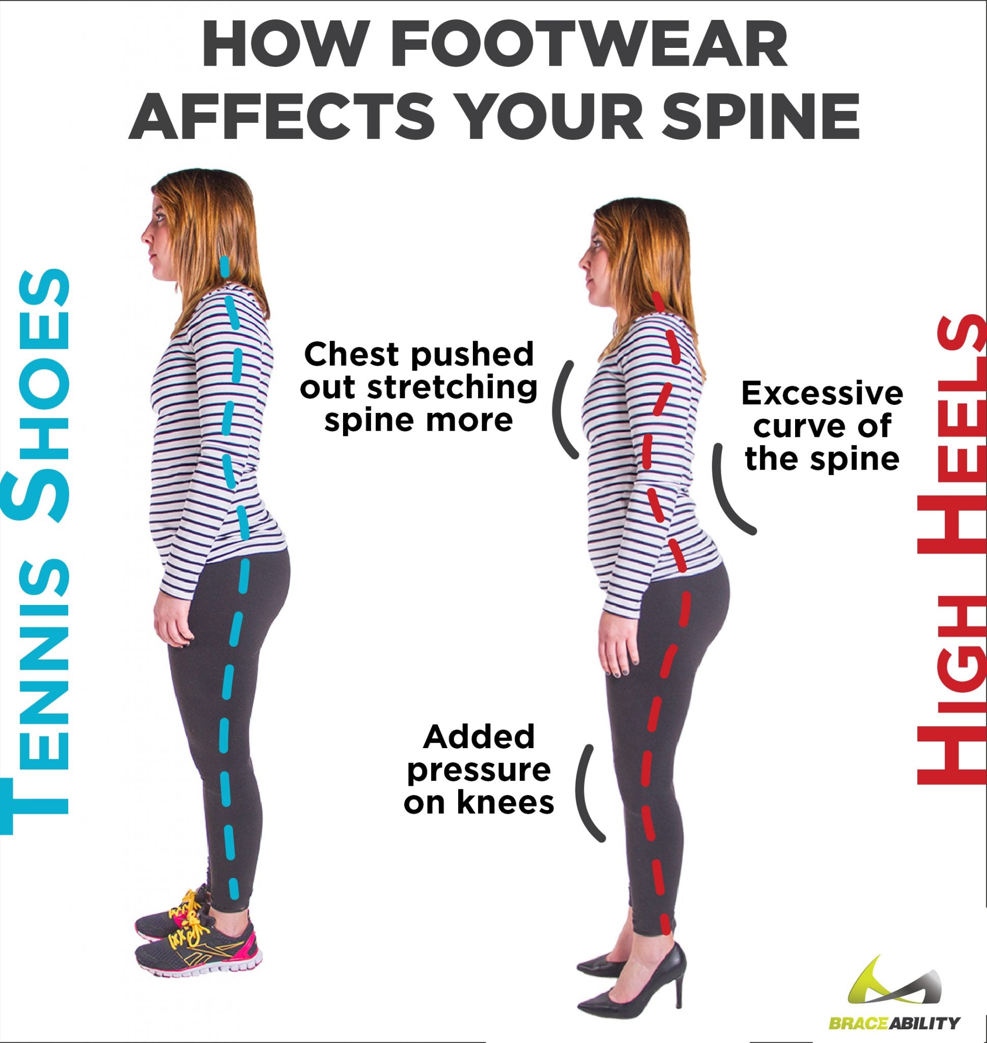 back pain from heels