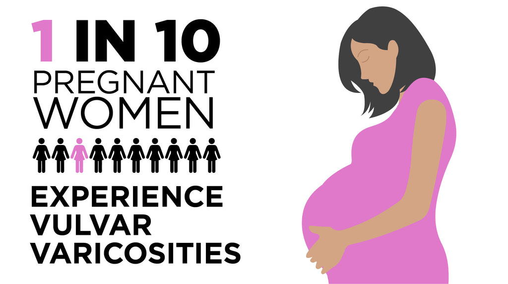 1 in 10 pregnant women experience vulvar varicosities