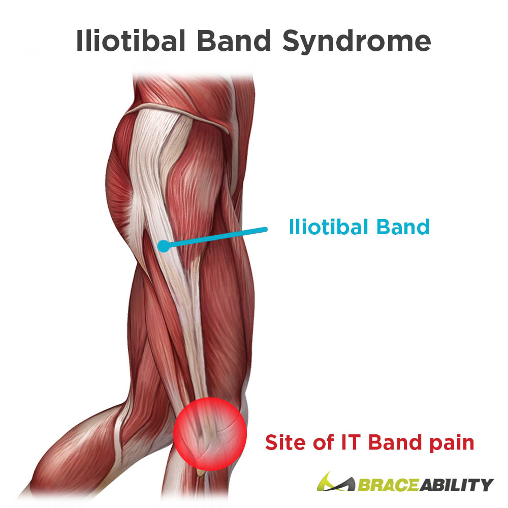 learn about iliotibial band anatomy and itbs pain