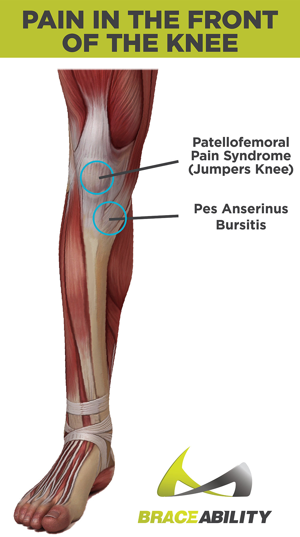 types of pain you feel in the front of your knee - patellofemoral pain syndrome, jumpers knee and pes anserinus bursitis