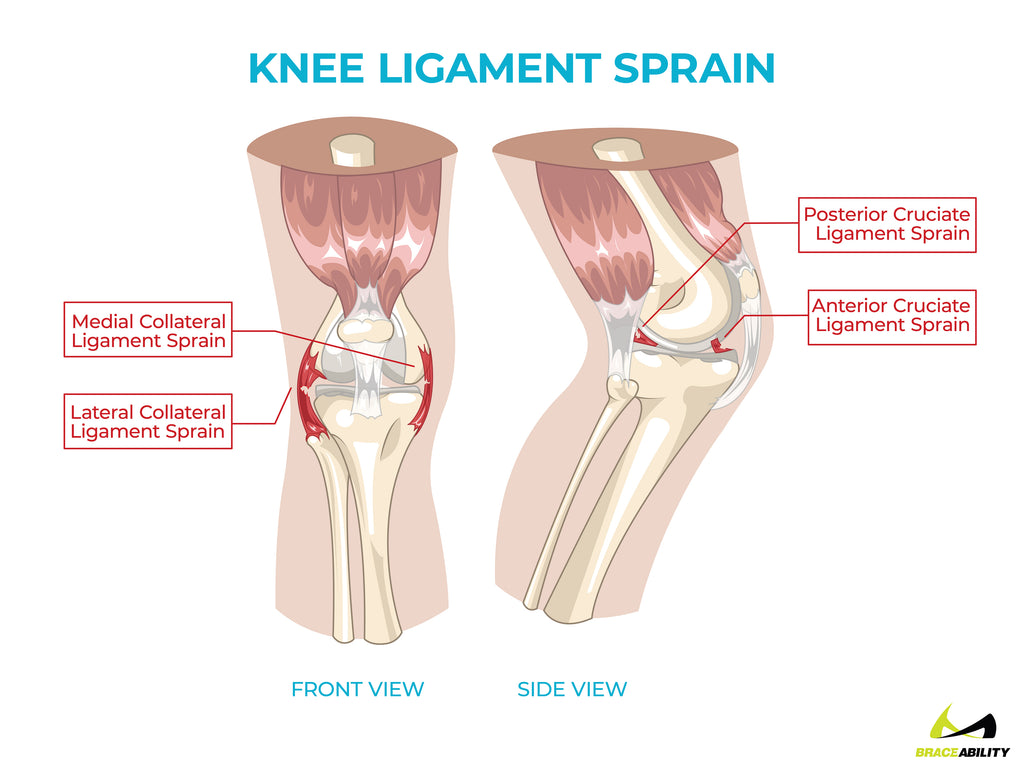 anatomy of knee ligament sprains causing back of knee pain