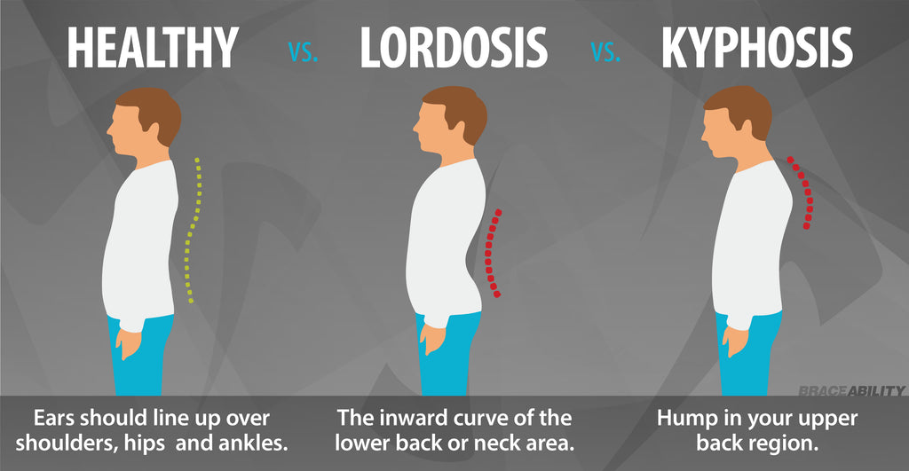 the difference between lordosis and kyphosis is lordosis is a curve in the lower spine and kyphosis is a curve in the upper spine