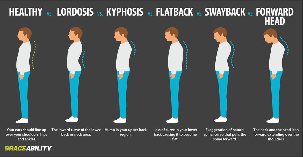 difference between kyphosis, lordosis, and flat back is where the curve of your spine is