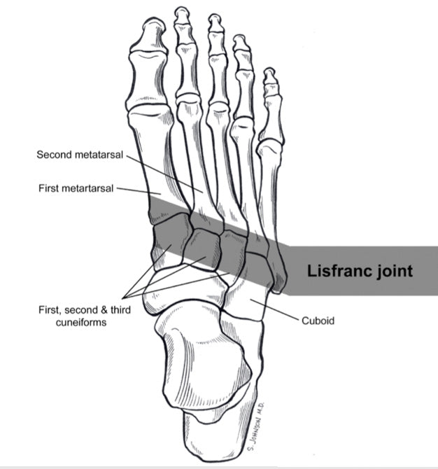 Lisfranc foot injury diagram location near heal