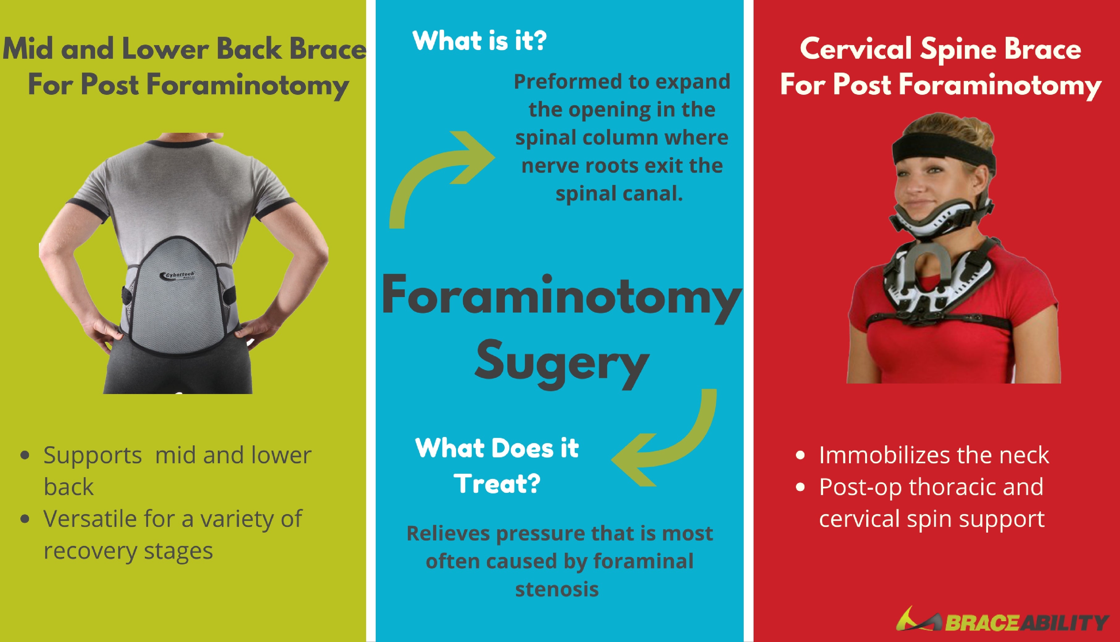 The best brace for post lumbar or cervical foraminotomy surgery