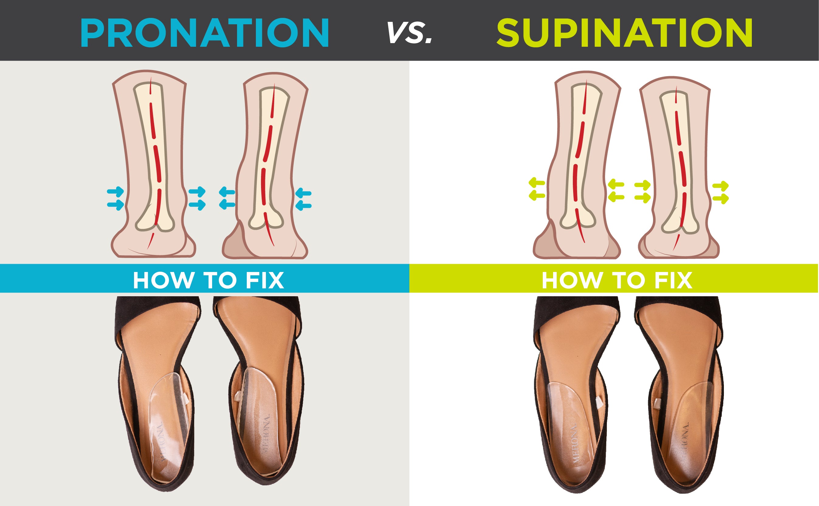 graphic showing the difference between supination and over pronation and how heel wedges can help fix them