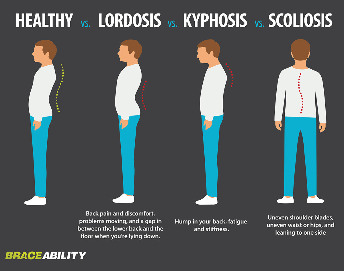 infographic on the difference between different spine curvature disorders - lordosis, kyphosis and scoliosis