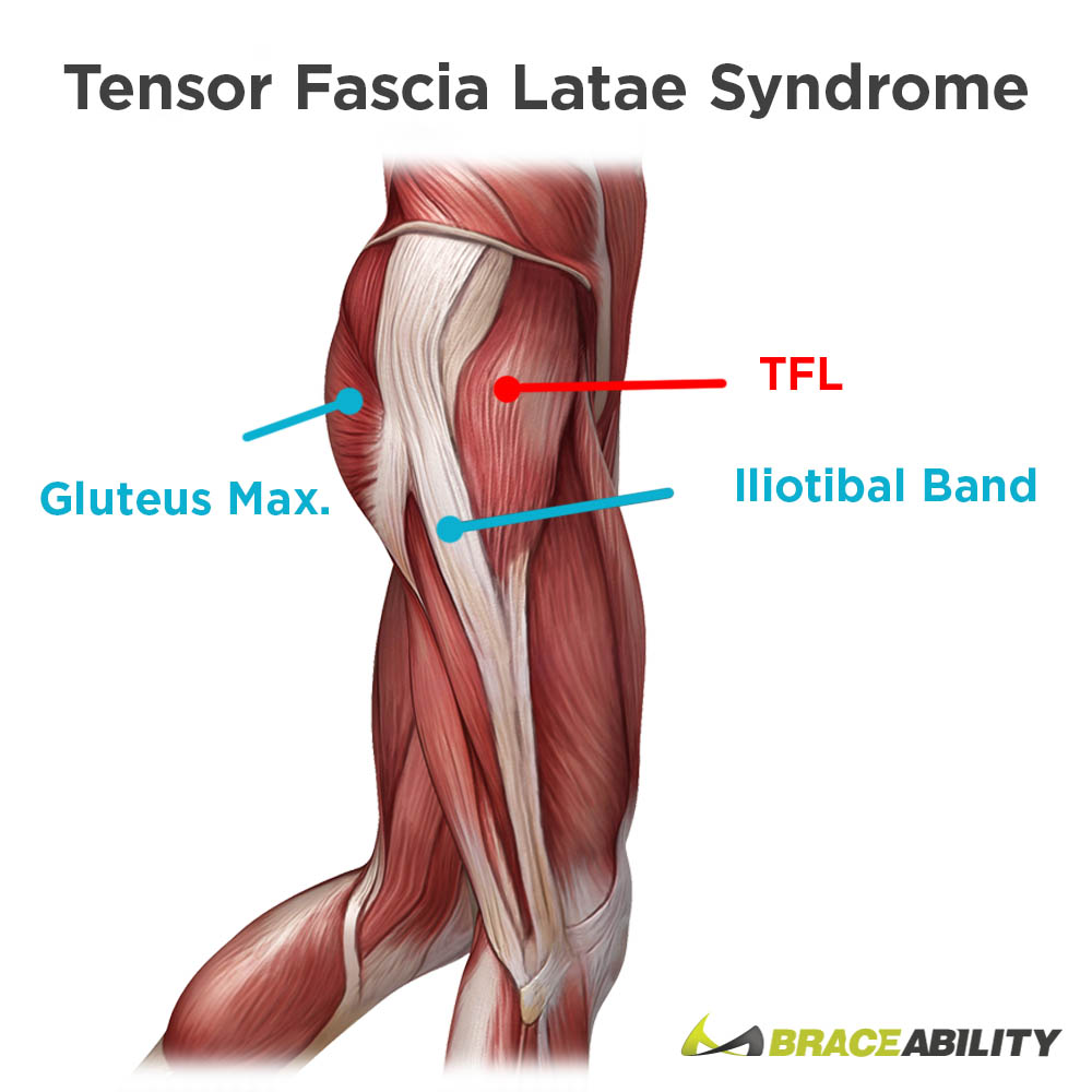 tensor fascia latae anatomy and pain from muscle tears or strains