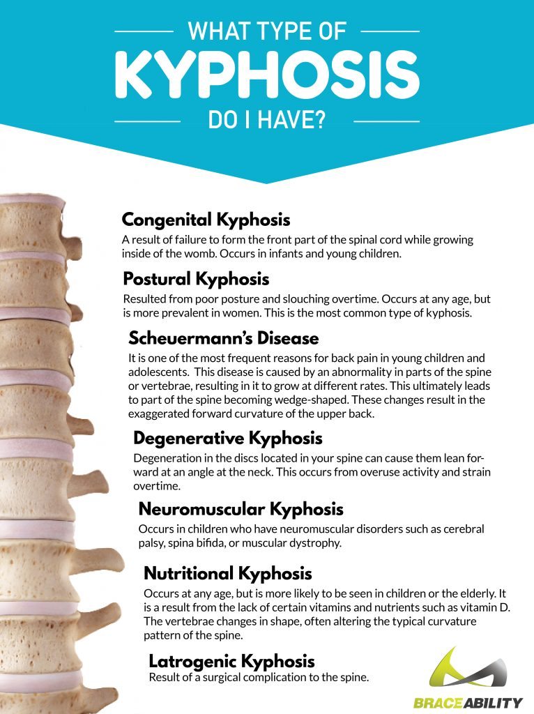 there are many kinds of kyphosis included in this chart including congenital, postural, degenerative and neuromuscular