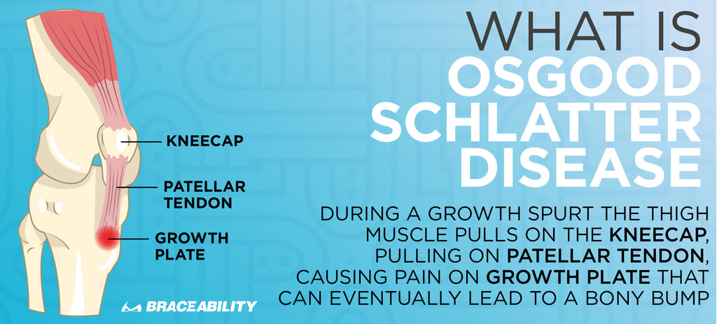 Osgood schlatter disease occurs when muscles are growing too fast and the patellar tendon stretches the growth plate below the kneecap causing a bump