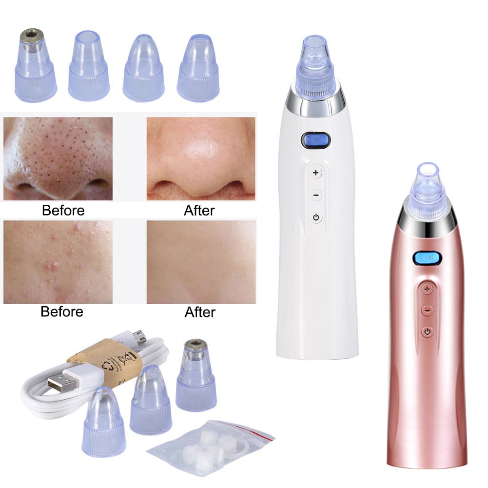 Electric Facial Pore Suction Cleansing Kit