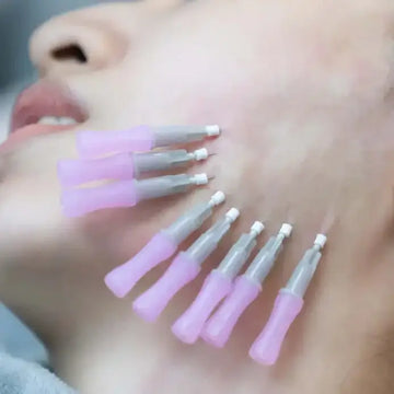FaceFix: Thread Lift