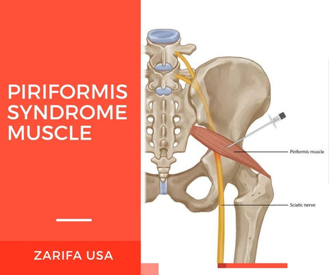 Massage Guns for Piriformis Syndrome