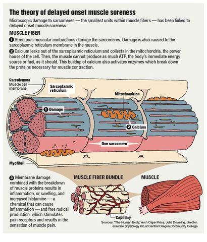 DELAYED ONSET MUSCLE SORENESS