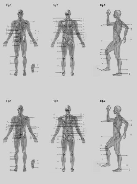 Tens Unit Placement Chart