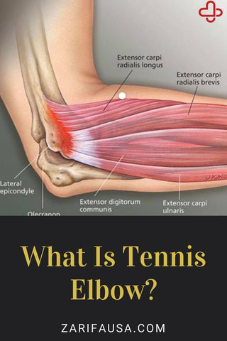 what is tennis elbow