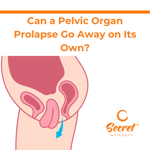 Can a Pelvic Organ Prolapse Go Away on Its Own