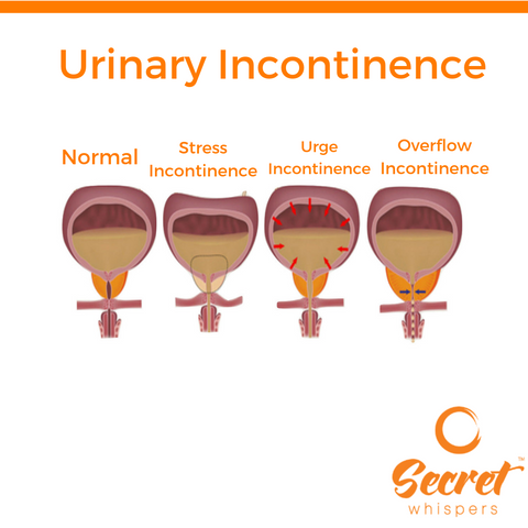 How To Prevent Urinary Incontinence