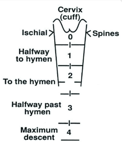 image of prolapse grades