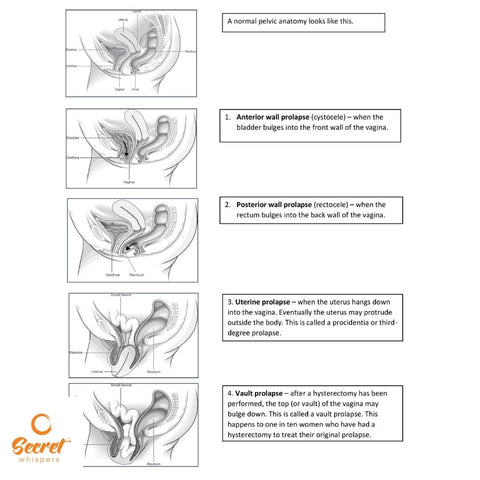 pelvic floor diagram