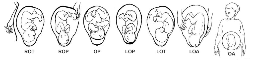 Baby Womb Positions