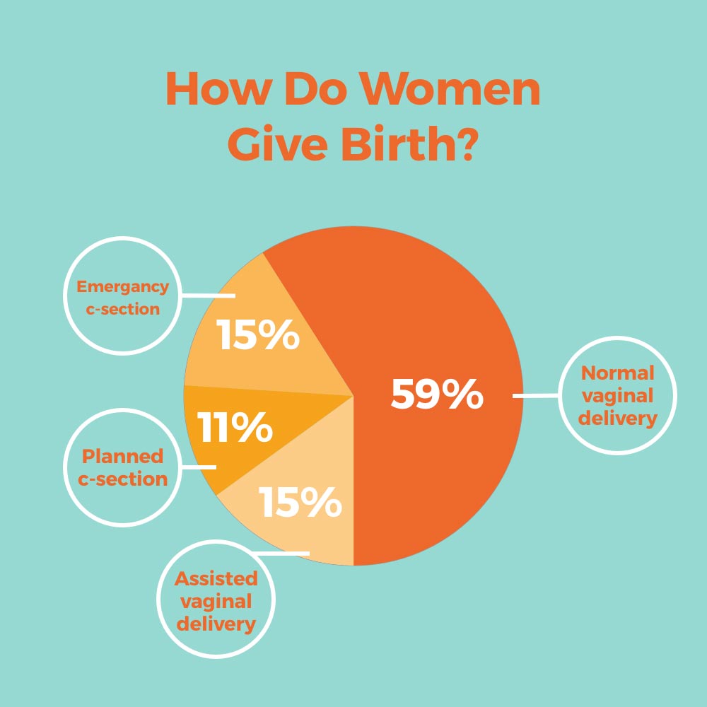 How Women Give Birth Pie Chart