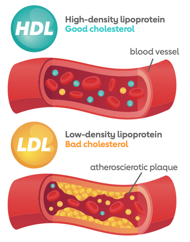 HDL and LDL Visualization by the American Heart Association