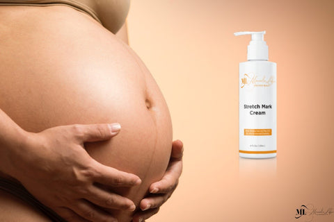 Best natural stretch mark removal cream for pregnant women