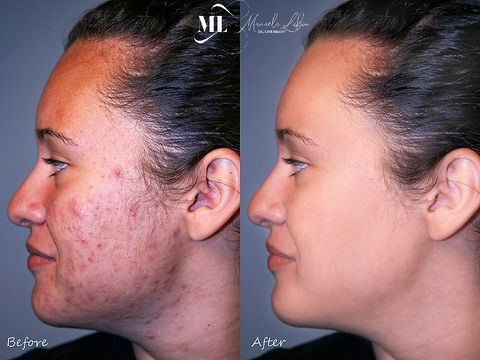 Skincare | Retinol moisturizer