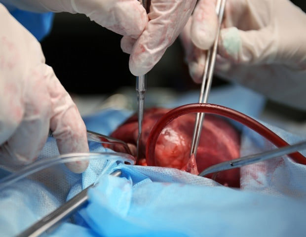 Study clarifies pros and cons of openheart surgery versus