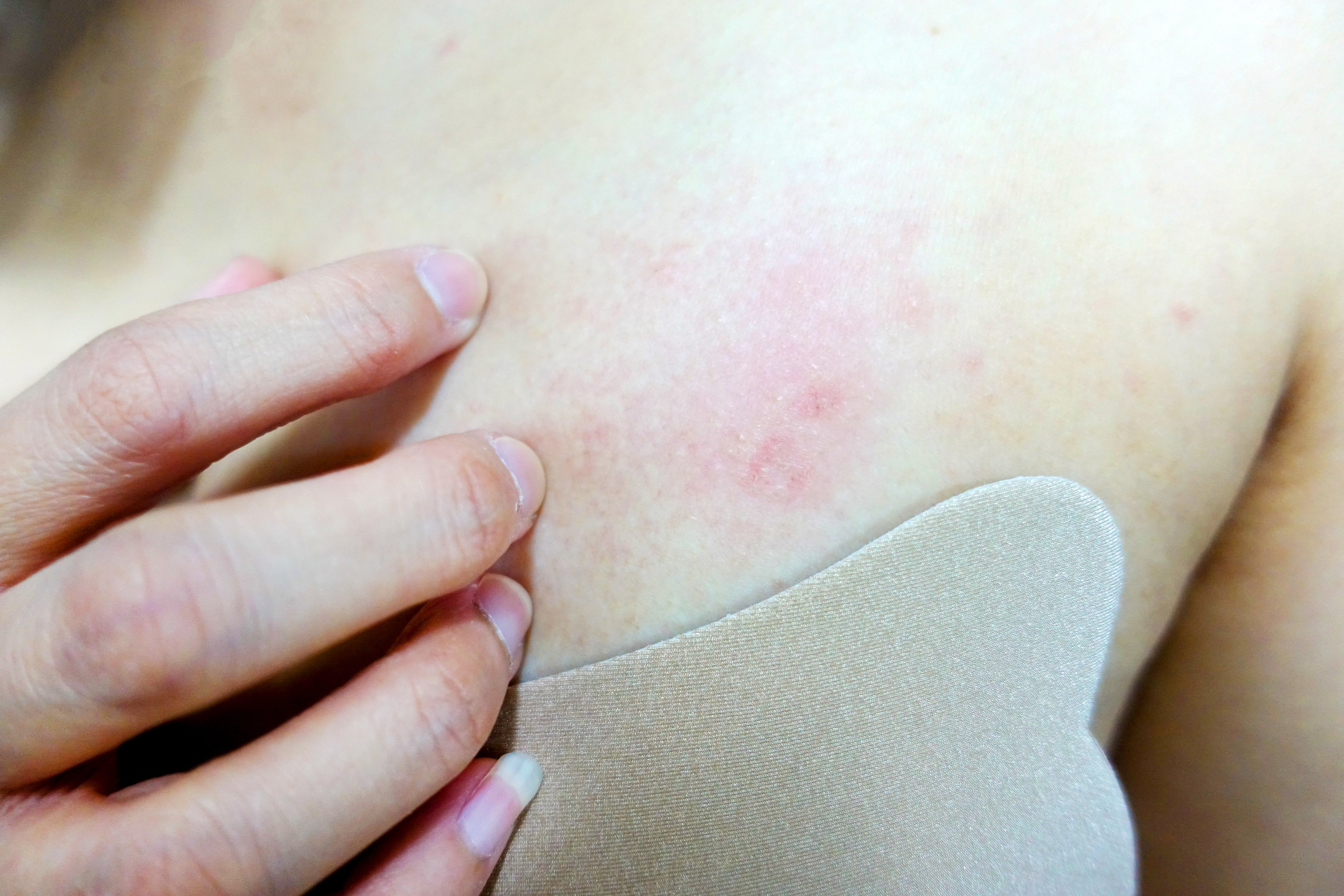 4 Common Skin Reactions Brought by Wearing the Wrong Bras – Cottonique -  Allergy-free Apparel