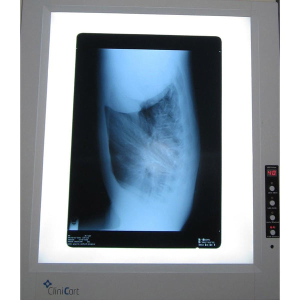 Medshop Single Bay X-Ray Viewers LED X-Ray Viewer Single Bay