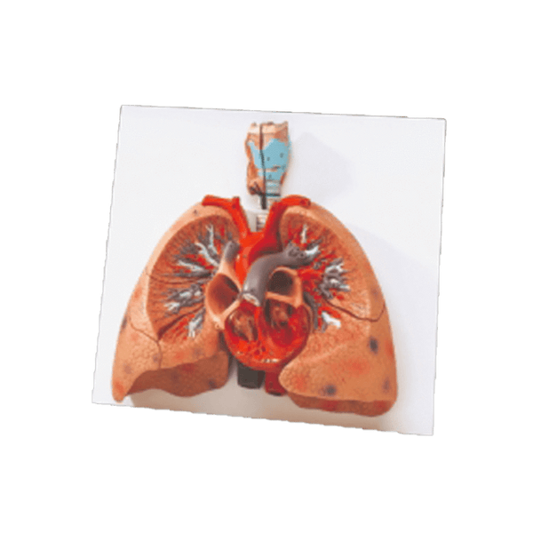 3B Scientific Anatomical Model Lungs With Heart Model