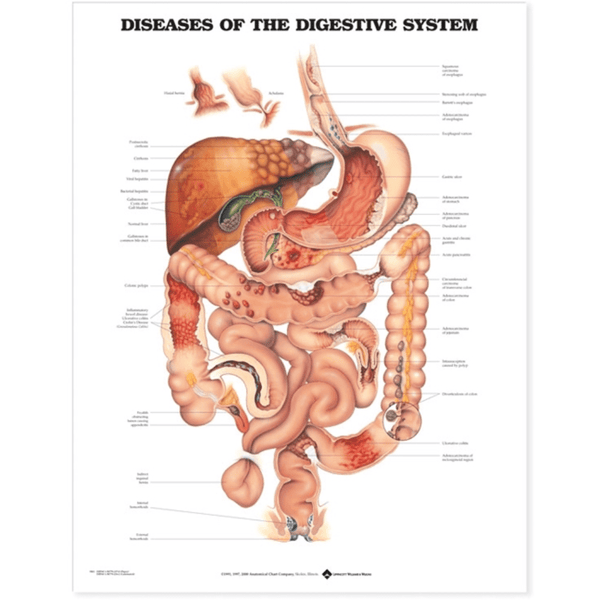 Anatomical Chart Company Anatomical Charts Diseases of the Digestive System Anatomical Chart