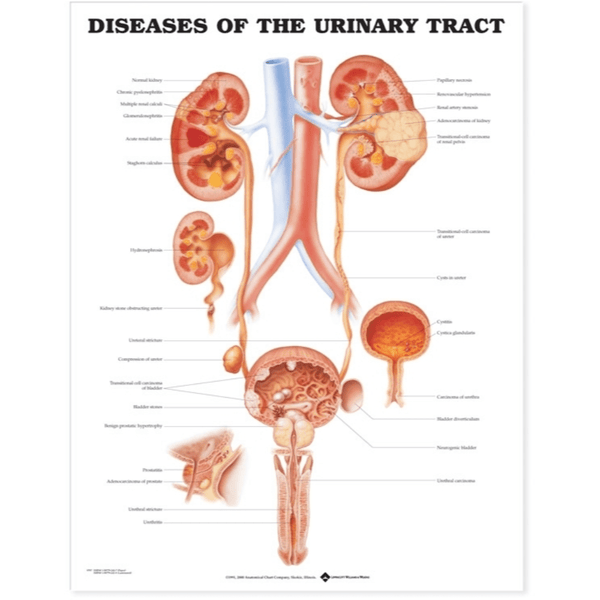 Anatomical Chart Company Anatomical Charts Diseases of the Urinary Tract Anatomical Chart