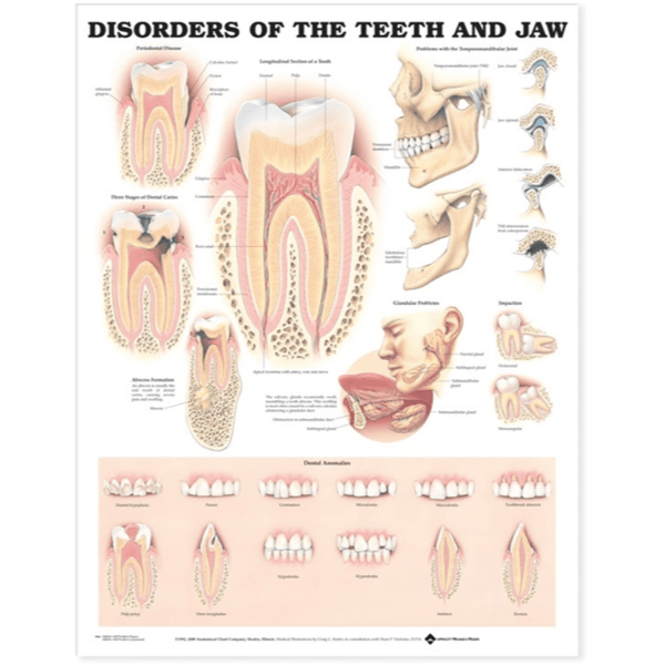 Anatomical Chart Company Anatomical Charts Disorders of the Teeth and Jaw Anatomical Chart