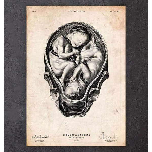Codex Anatomicus Anatomical Print A5 Size (14.8 x 21 cm) Fetus In A Womb Anatomy Print II