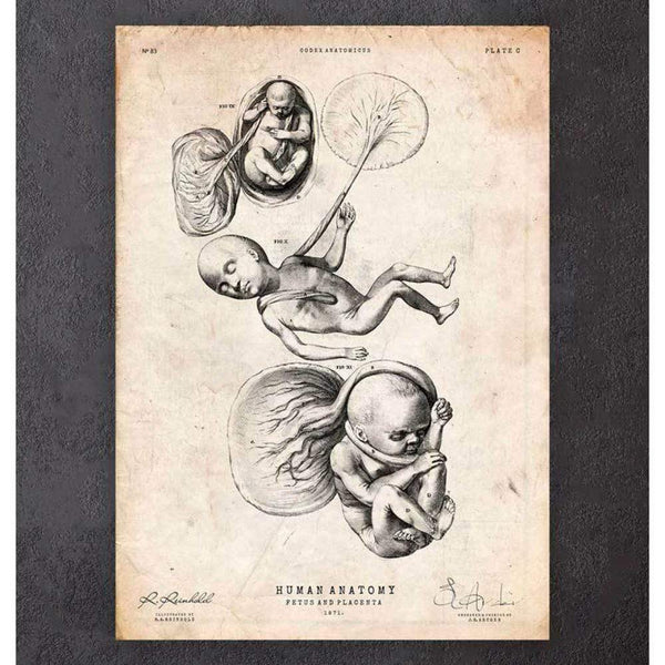Codex Anatomicus Anatomical Print Fetus In A Womb Anatomy Print III