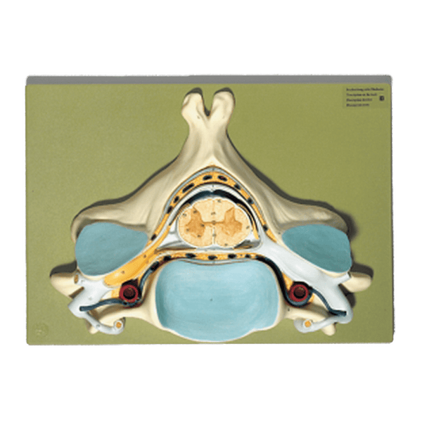 Somso Modelle GmbH Model Fifth Cervical Vertebra